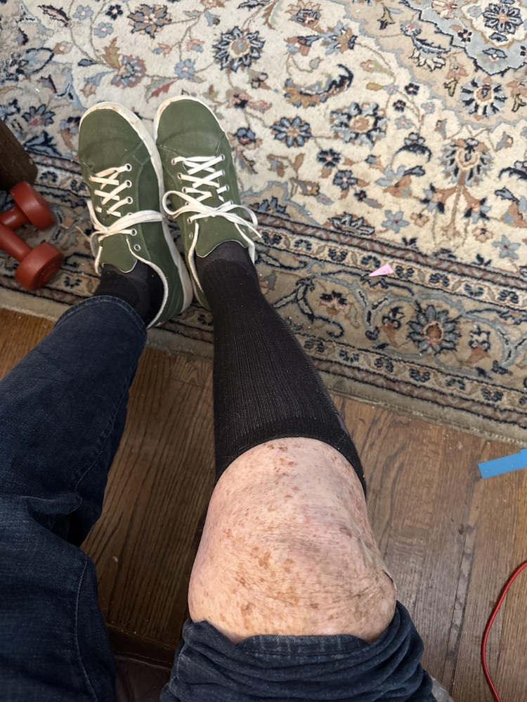 Hollow compression socks worn by a customer