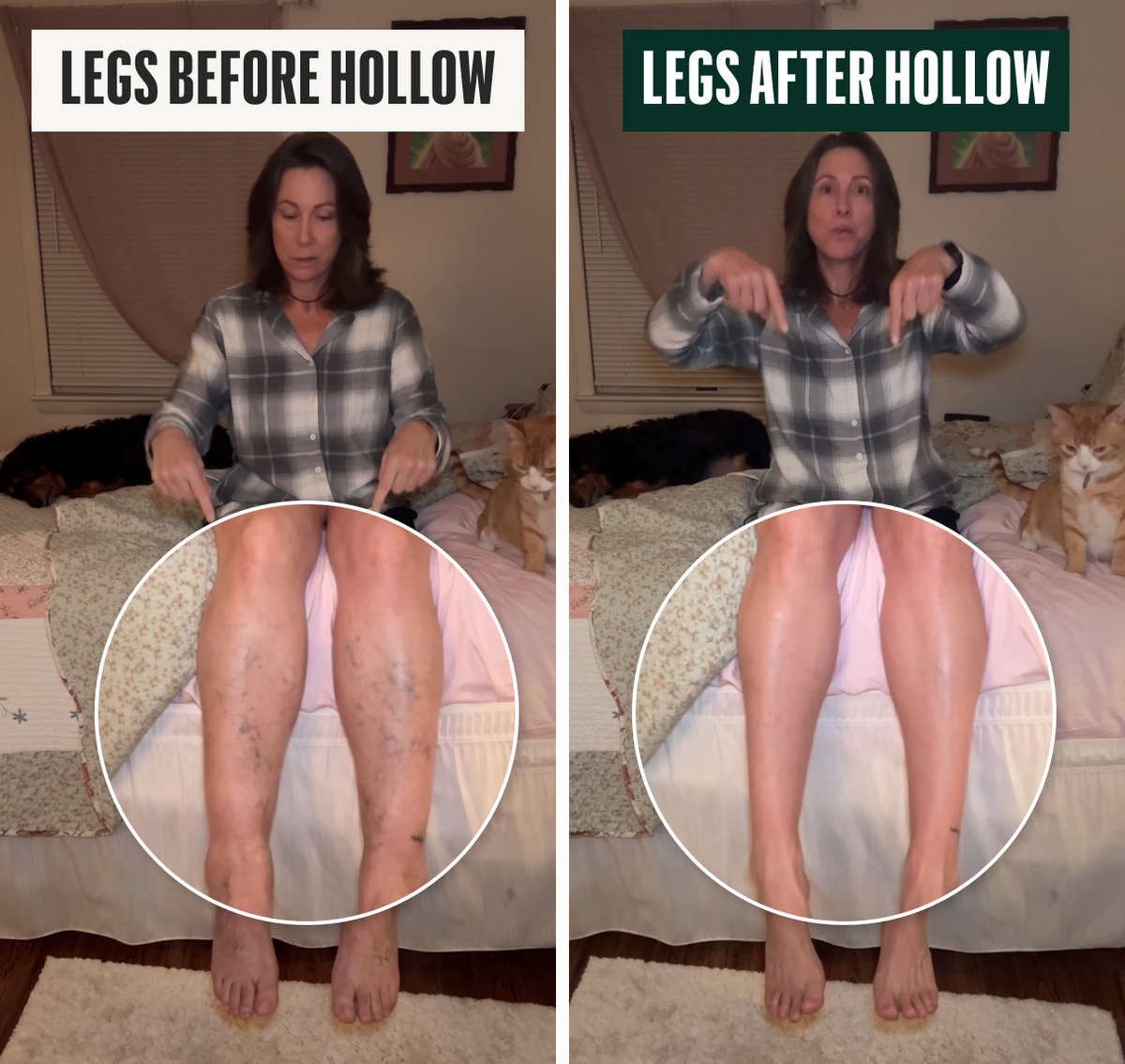 Legs before Hollow and legs after Hollow comparison